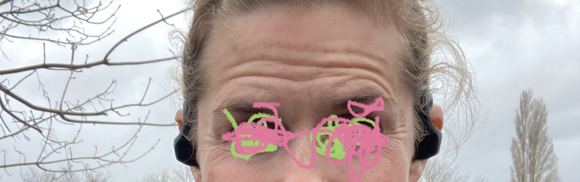 Age is not being kind… with pic! Botox needed, and what else??