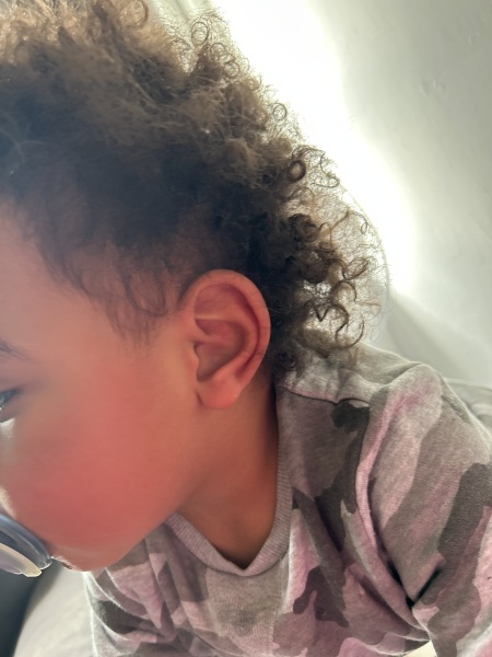 Toddler Molars