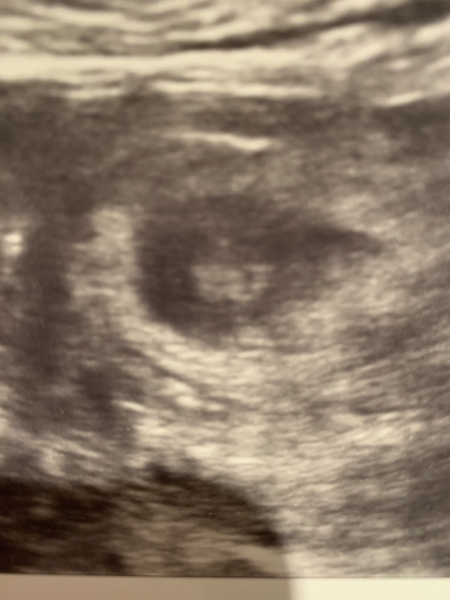 Due November 2023 ✨