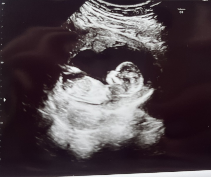 Gender prediction 13+2
