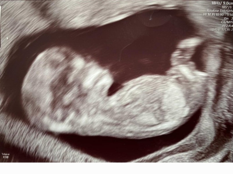 After 7 years of trying I have just found out I am pregnant 