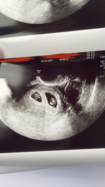 Due October 2023 - thread 3