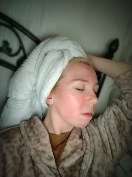 Did your DC take Roaccutane, and how old were they?