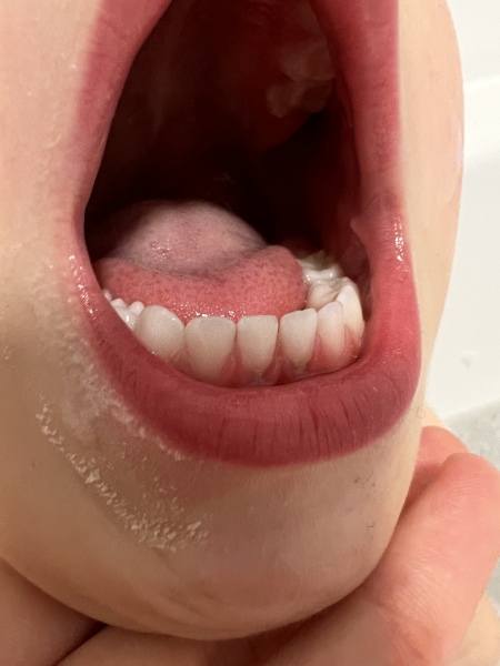 3 year old tooth. 