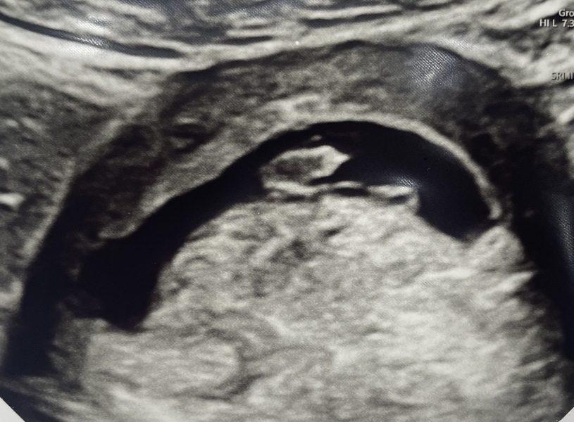 Due October 2023 - thread 3