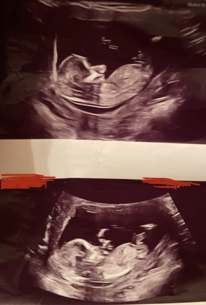 Please help with your gender guesses