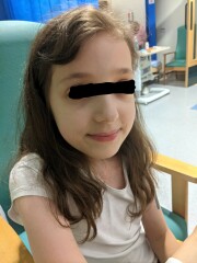 Potential IBD