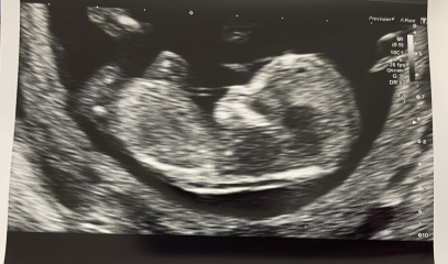 September baby - Boy or Girl? 