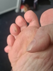 What is wrong with my toe? (photos attached)