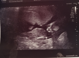 Due September 2023 after miscarriage 🌈