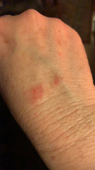 Really effective handcream