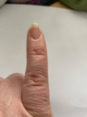 Finger