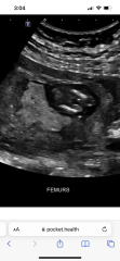 Nub and potty shot guesses (13 weeks 4 days)
