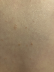 Rash on 2 year old