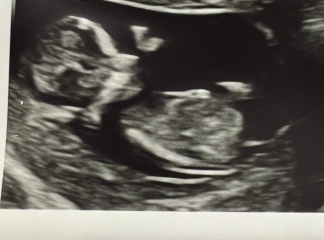 Boy or girl?