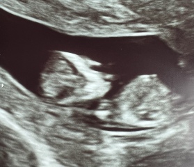 What’s your gender guess?