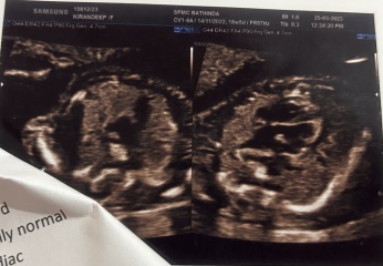 Due end of Aug/Sept babies 🤞🏻