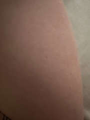 Tiny red dots 