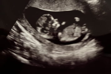 End Aug/Early Sept Due Date (Thread 2)