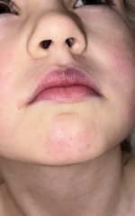 Purple lips in bath?
