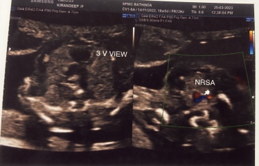 Due end of Aug/Sept babies 🤞🏻