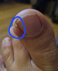 Big toe  anyone know what this lump is? (Pic attached)