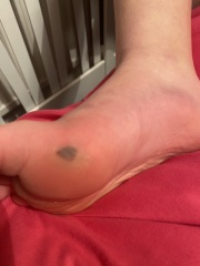 What is this?