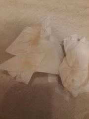 Anyone have similar implantation bleeding 8 and 9 dpo? Pictures below 