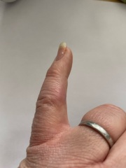 Finger