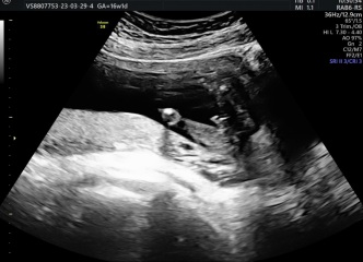 Can someone confirm gender please?