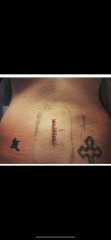 Agonising back pain