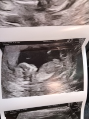 genders for our twins:)