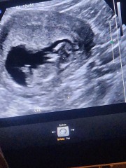 Gender guesses