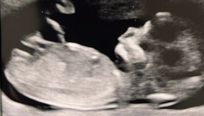 Boy or girl?