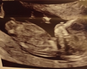 Gender guess 