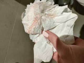 Implantation bleeding.