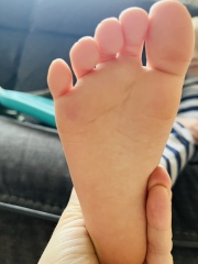 Can anyone help me figure out what's wrong with my sons feet? *pic*