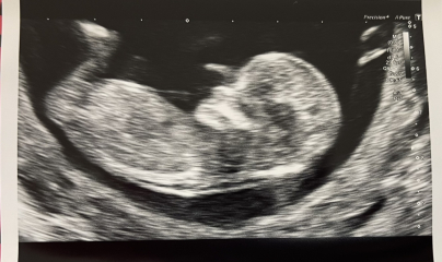September baby - Boy or Girl? 