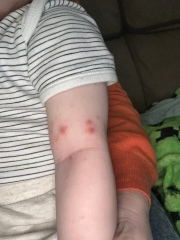 What are these spots?
