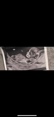 Can you guess my baby’s gender?