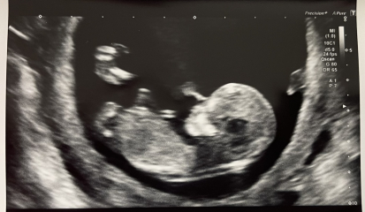 12 weeks 5 days - Blue or Pink? 