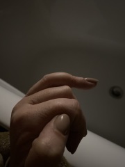  malignant osseous tumors of the fingers?