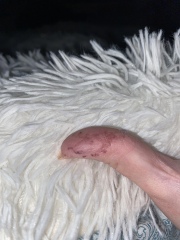 what’s wrong with my fingers