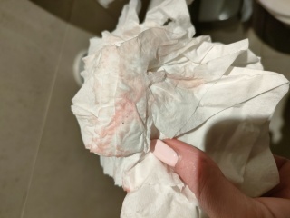 Implantation bleeding