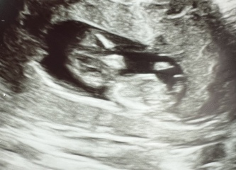 Boy or girl?