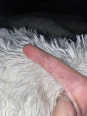 what’s wrong with my fingers