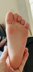 Can anyone help me figure out what's wrong with my sons feet? *pic*