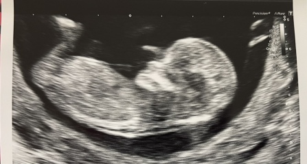 12 weeks 5 days - Blue or Pink? 