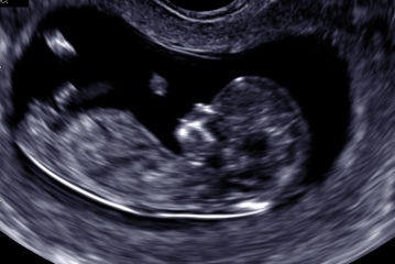 Is this a boy nub?