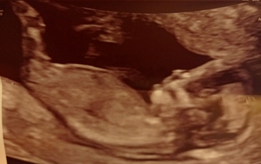 Gender guess 